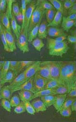 wide-type pxillin cells