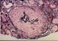 Case B Thumbnail Image 2