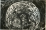 Case B Thumbnail Image 3