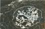 Case B Thumbnail Image 4