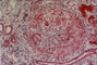 Case B Thumbnail Image 1