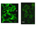 Case Z Biopsy Thumbnail Image 4