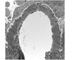 Case Z Biopsy Thumbnail Image 5
