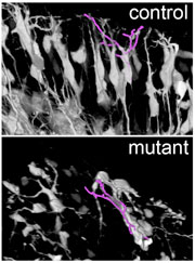 image of Reelin-sigaling deficient mutant compared to control littermate