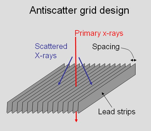 Scatter Removal Grids Radiology SUNY Upstate Medical University