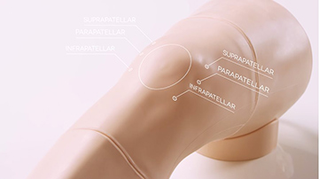 Knee Aspiration & Examination with Ultrasound capabilities