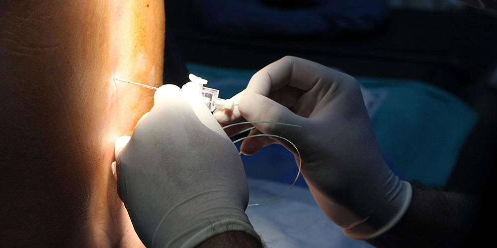Doctor performing a epidural procedure
