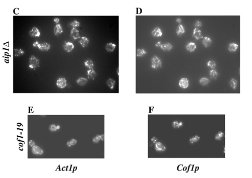 cofilin dependance