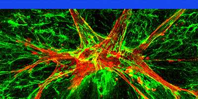 Tumor Microenvironment and Invasion
