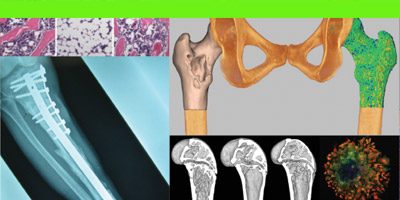 Translational Program in Lifetime Survivorship