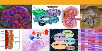 Translational Program in Urological Cancers