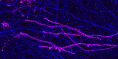 Myelin sheaths (magenta) wrapping axons (blue) in the rodent brain