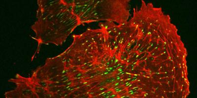 Actin filaments (red) and focal adhesions (green) in a kidney cell that is involved in filtering out toxic waste. Image credit: Jing Bi Karchin and Mira Krendel