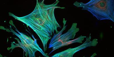 Actin cytoskeleton in mouse tumor fibroblasts. Image credit: Greg Goreczny, Turner lab