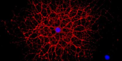 Differentiated oligodendrocyte, the myelin sheath forming cells of the CNS