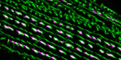 Integrin (green) and alpha-actinin (magenta) in worm muscle. Image credit: Sumana Sundaramurthy, Pruyne lab