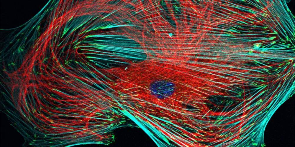 Cytoskeletal organization in a cancer-associated fibroblast