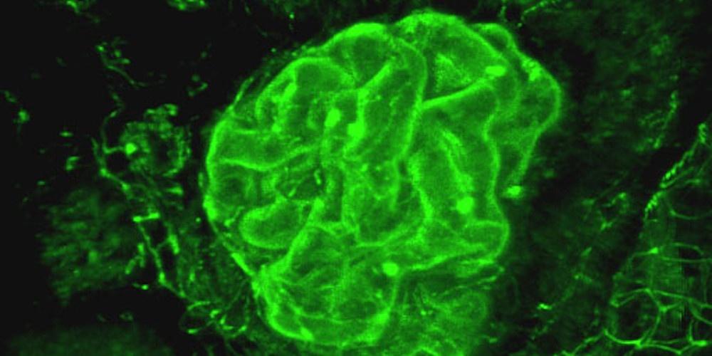 3D reconstruction of a renal filtration unit, called the glomerulus
