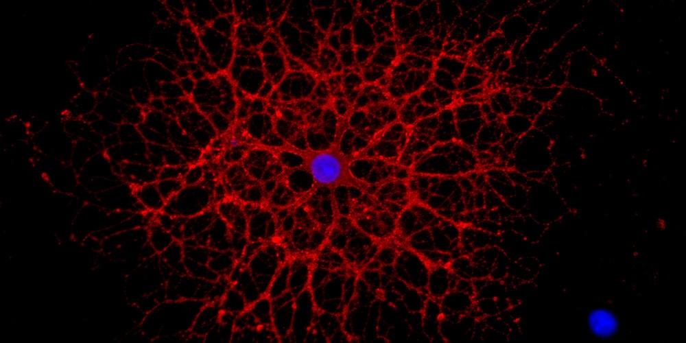 Differentiated oligodendrocyte, the myelin sheath forming cells of the CNS