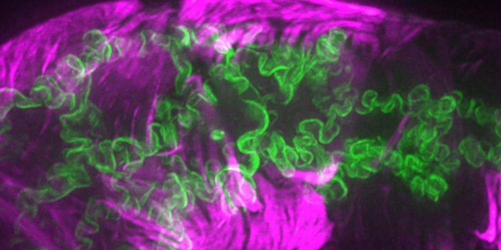 Cell-cell junctions (green) and actin filament bundles (magenta) in the worm spermatheca