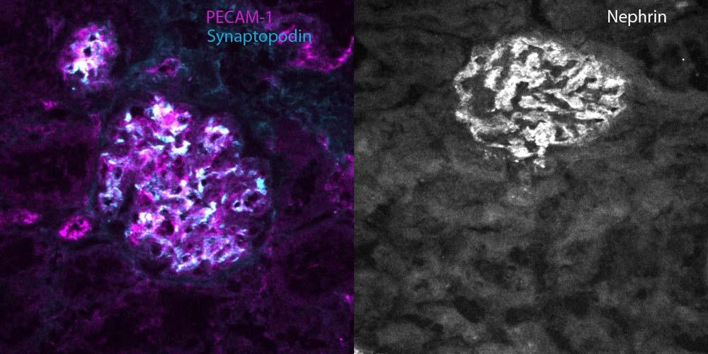 Immunofluorescence staining