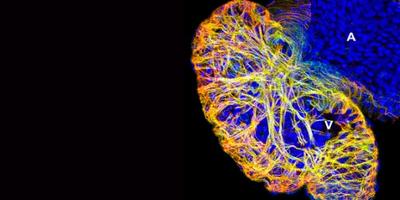 Research of Jean Sanger, Ph.D. Confocal image of a projection of focal planes through a three day-old embryonic zebrafish heart (ventricle V and atrium A) showing the distribution of the forming myofibrils. Nuclei, stained with DAPI are blue.