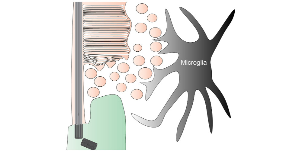 microglia attempt to clear the vesicular debris