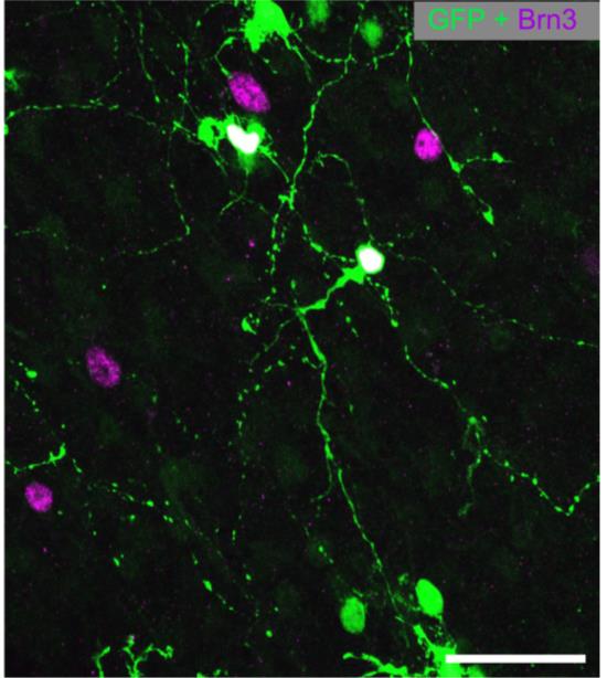 retinal ganglion