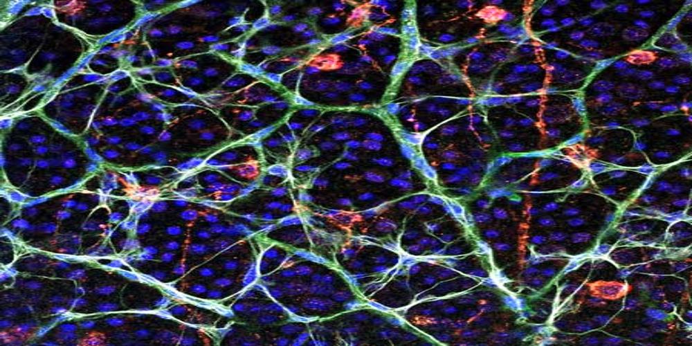 Retinal Vasculature Image