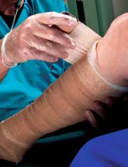 Wound Care