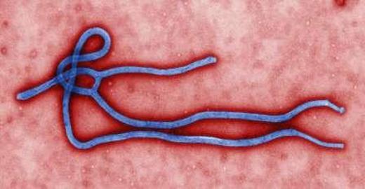 Ebola virus.