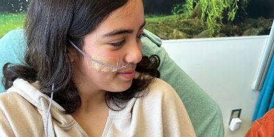 Adolescent with NG tube