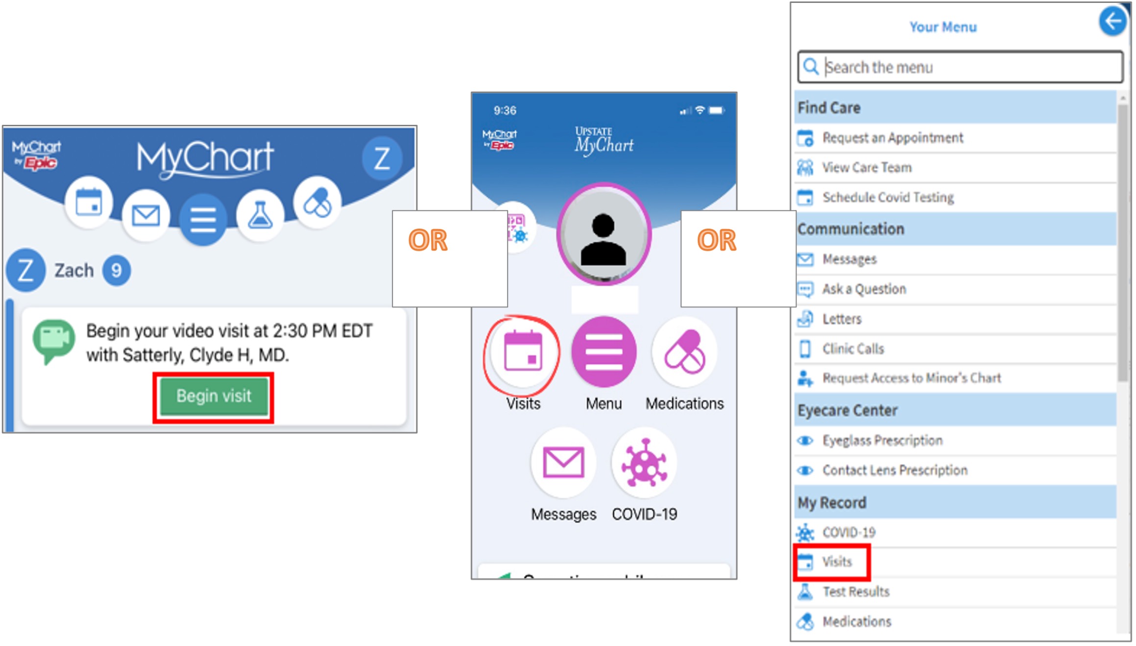 mycharts 