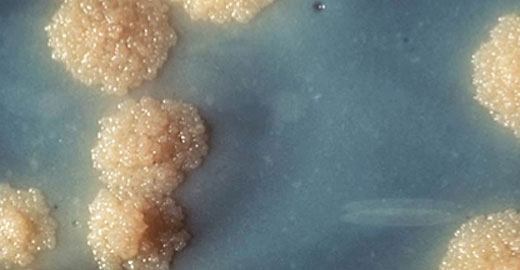 Division of Infectious Disease