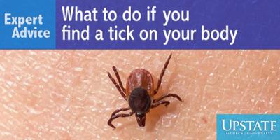 Expert Advice: What to do if you find a tick on your body