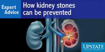 Expert Advice: How kidney stones can be prevented