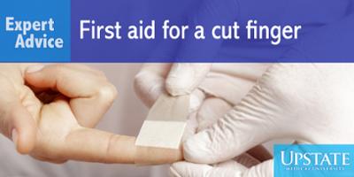 Expert Advice: First aid for a cut finger