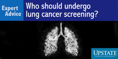 Expert Advice: Who should undergo lung cancer screening?