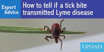 Expert Advice: How to tell if a tick bite transmitted Lyme disease