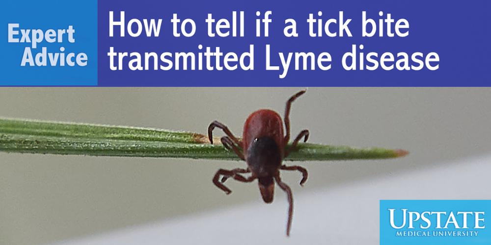 Expert advice how to tell if a tick bite transmitted lyme disease