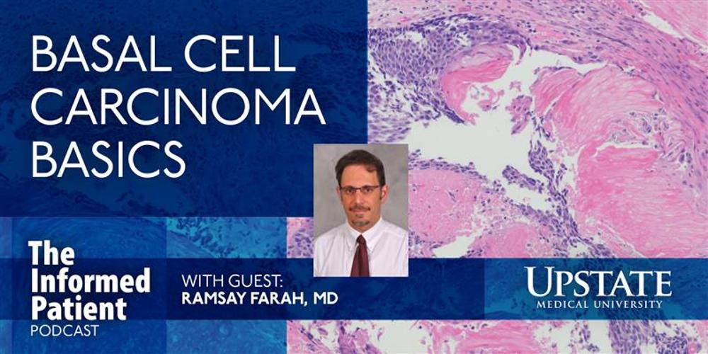 Basal cell carcinoma basics, with guest Ramsay Farah, MD, on Upstate's "The Informed Patient" podcast