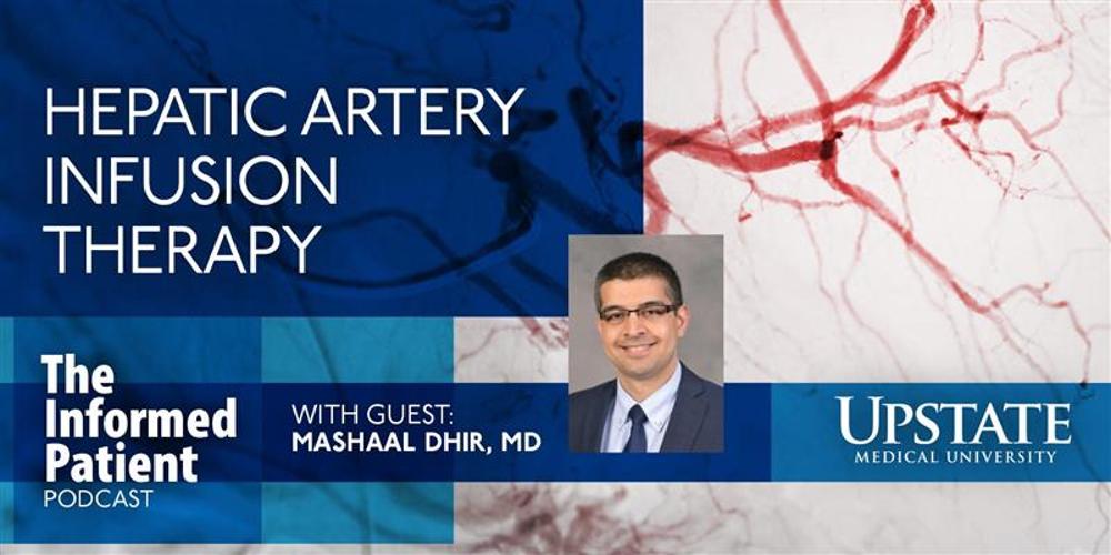 Hepatic artery infusion therapy, with guest Mashaal Dhir, MD, on Upstate's "The Informed Patient" podcast