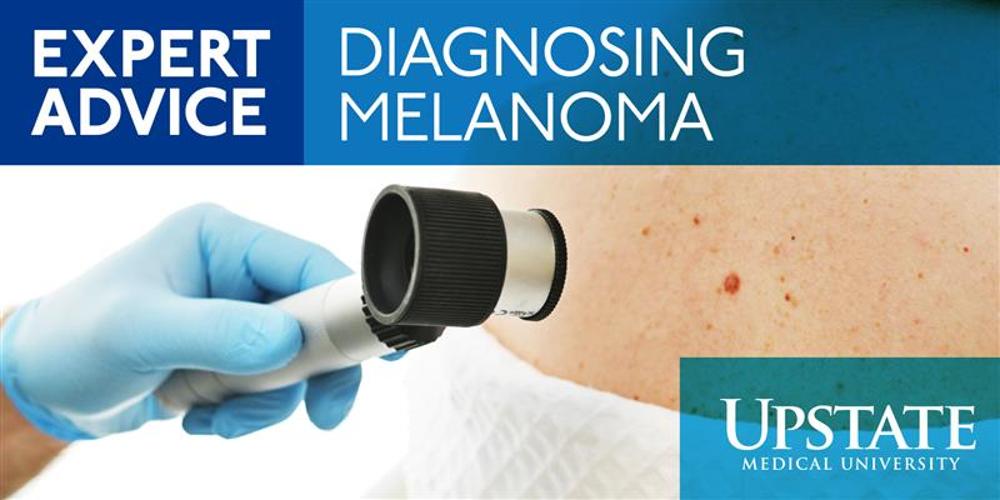 Diagnosing melanoma: Expert Advice from Upstate Medical University