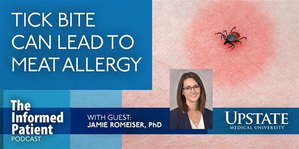 Tick bite can lead to meat allergy, with guest Jamie Romeiser, PhD, on Upstate's The Informed Patient podcast