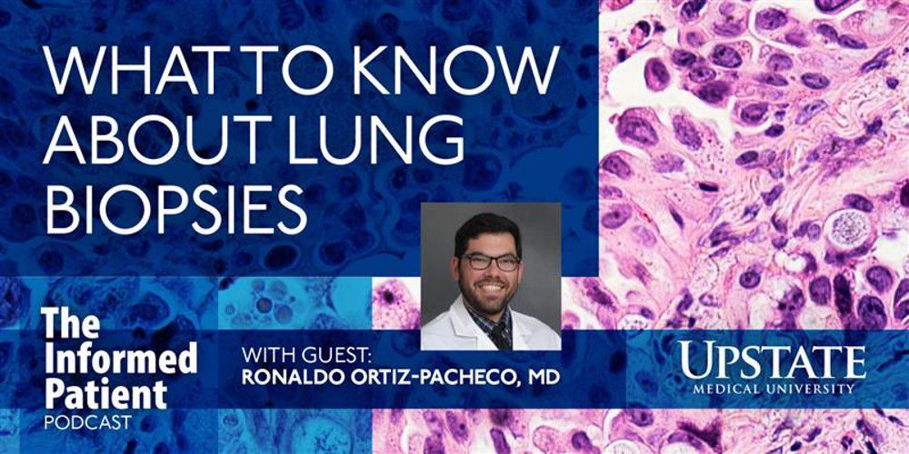 What to know about lung biopsies, with guest Ronaldo Ortiz-Pachecho, MD, on Upstate's The Informed Patient podcast