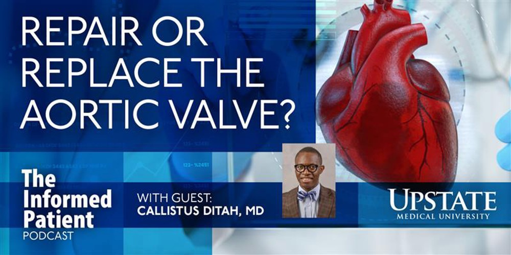 Callistus Ditah, MD, discusses whether to repair or replace the aortic valve on Upstate's The Informed Patient podcast.