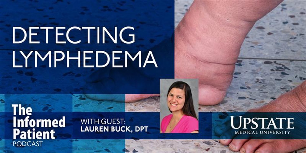 Detecting lymphedema, with guest Lauren Buck, DPT, on Upstate Medical University's The Informed Patient podcast