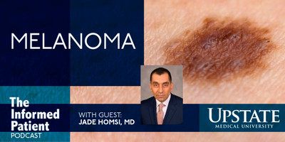 Melanoma diagnosis, treatment and outlook