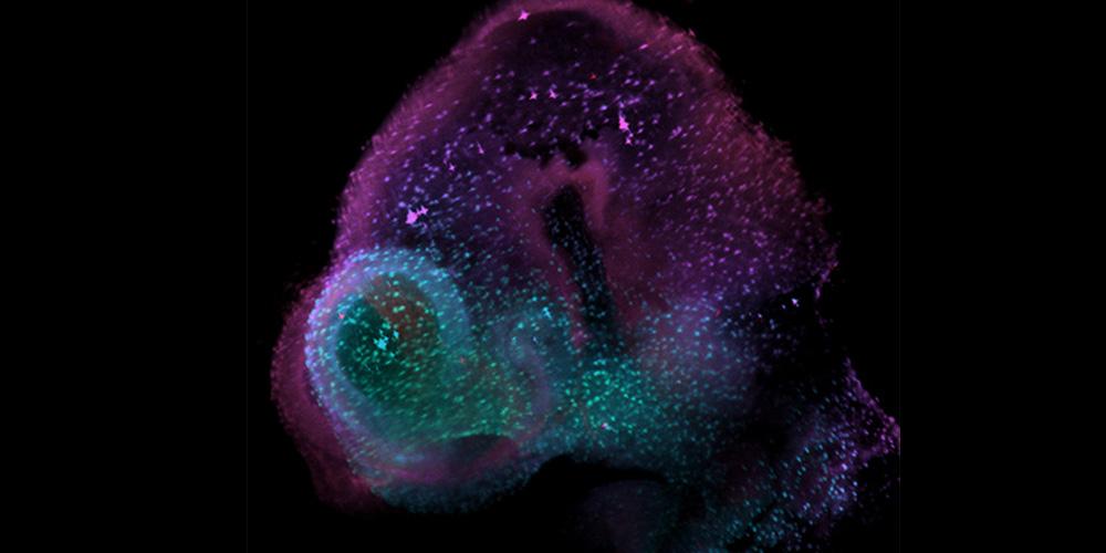 An image of a mouse embryo head, cleared using iDisco+ and labeled using a fluorescent conjugated antibody against pHisH3, a marker of cell proliferation.