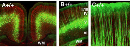 Developmental Neuroscience